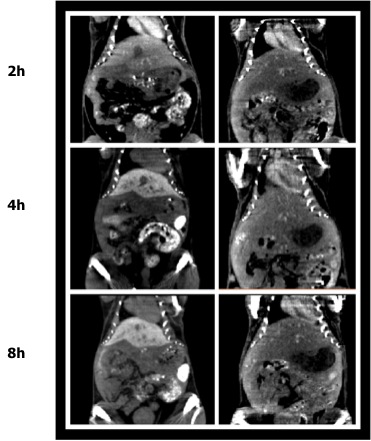 APOE Dependant Mechanism for Uptake