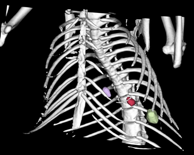 White paper for detecting lung metastases with Imalytics Preclinical