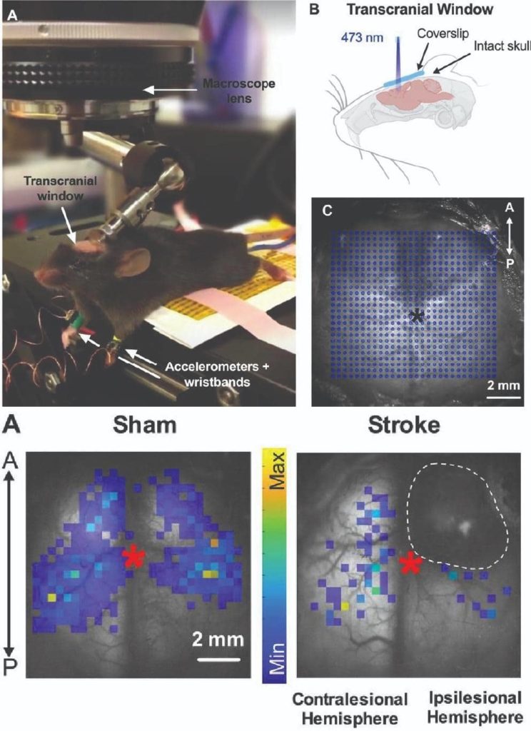 MediLumine LightTrack Optogenetics