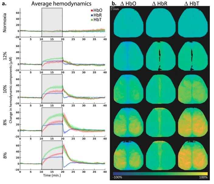 Use of non anesthetized models for intrinsic optical imaging. MediLumine
