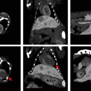 ExiTron™ MyoC 8000
