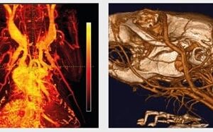 ExiTron™ nano 12000