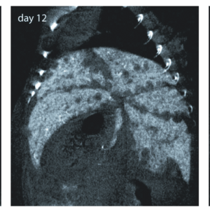 ExiTron™ nano 6000
